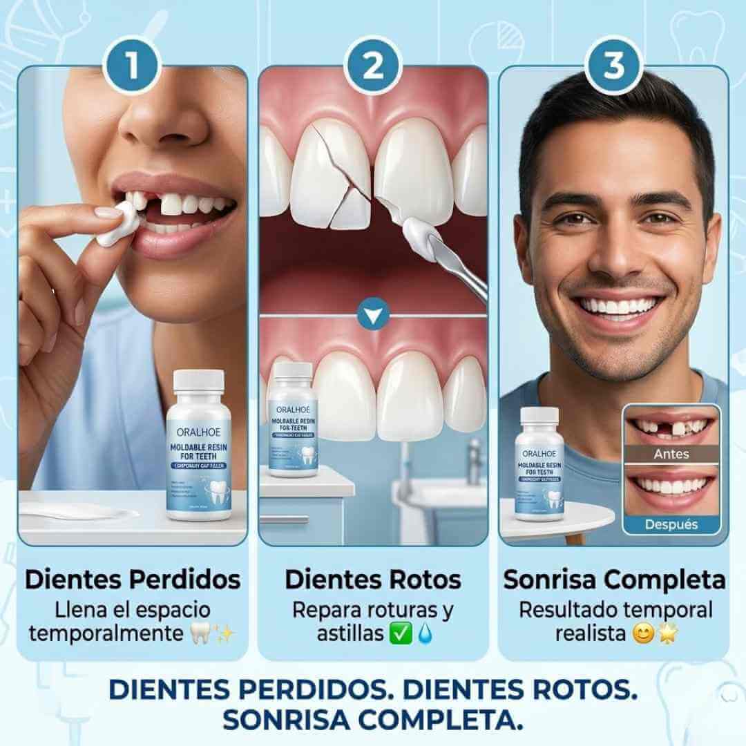 Resina Moldeadora Dental Oralhoe — repara dientes rotos o perdidos en casa en minutos sin ir al dentista + OBSEQUIO